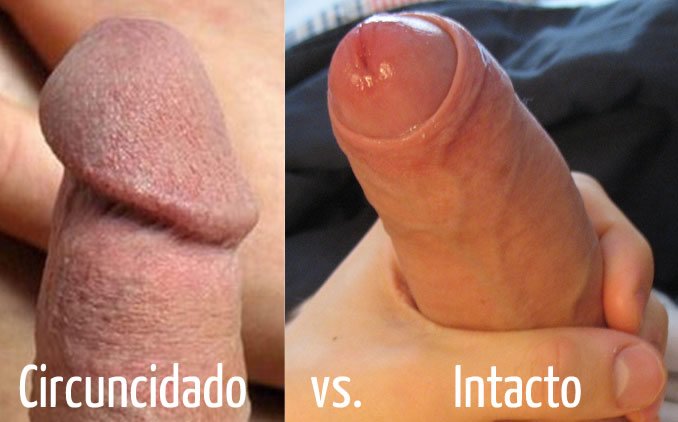 Comparativa